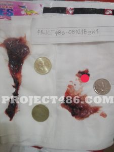abortion pills Mifepristone Misoprostol Cytotec Philippines Project 486