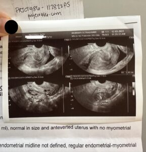 abortion clinic in mandaue cebu