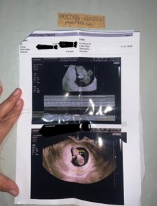 Abortion pills in dumaguete