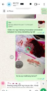 Abortion clinic in Vigan Ilocos Sur