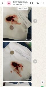 Abortion pills in Iloilo
