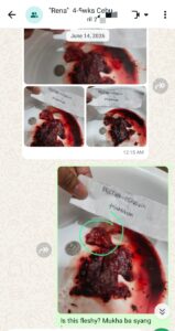 Where to find Abortion clinic in Cebu July 2026